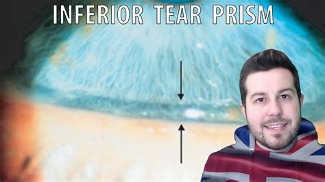 tear prism height test|BE THE DED DETECTIVE .